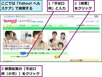 1「手足口病」と入力,2［検索］をクリック,3 検索結果の［手足口病（小児）］をクリック,ここでは「Yahoo! ヘルスケア」で検索する